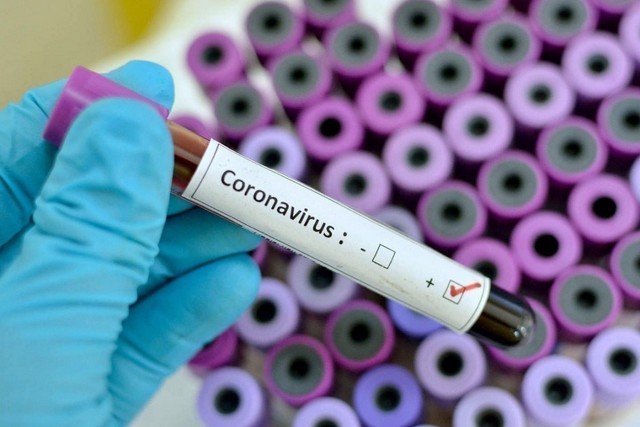 На Днепропетровщине зафиксировали первые два случая коронавируса