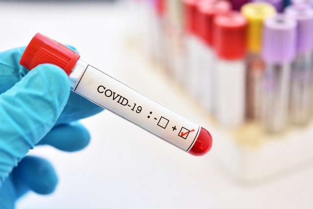       COVID-19.   䳺  